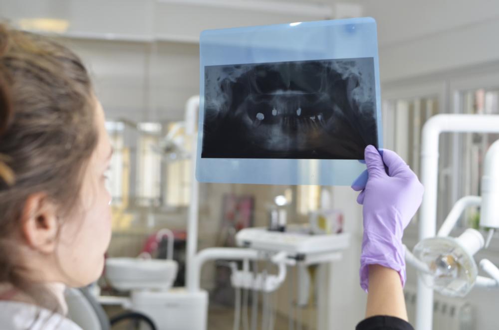 Emergency dentist in Webster Groves examining a digital x-ray scan
