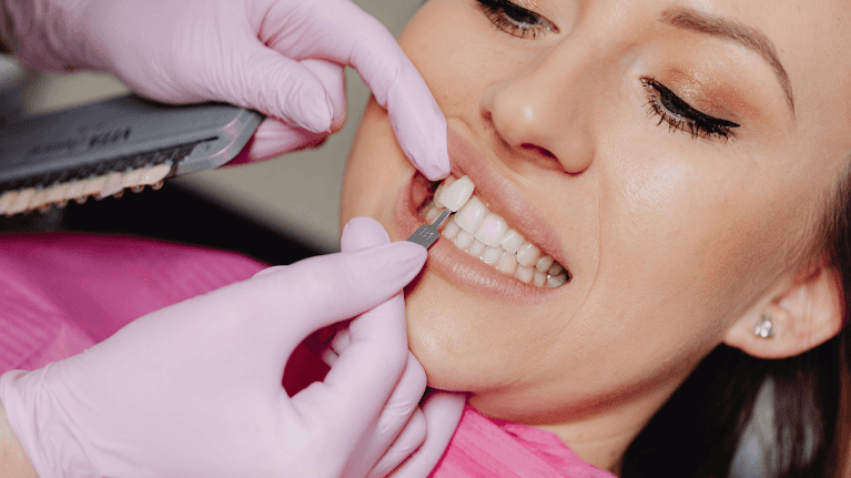 patient receiving porcelain veneers at Webster Groves Dental