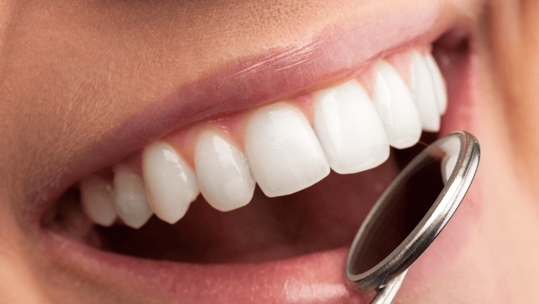 teeth exam