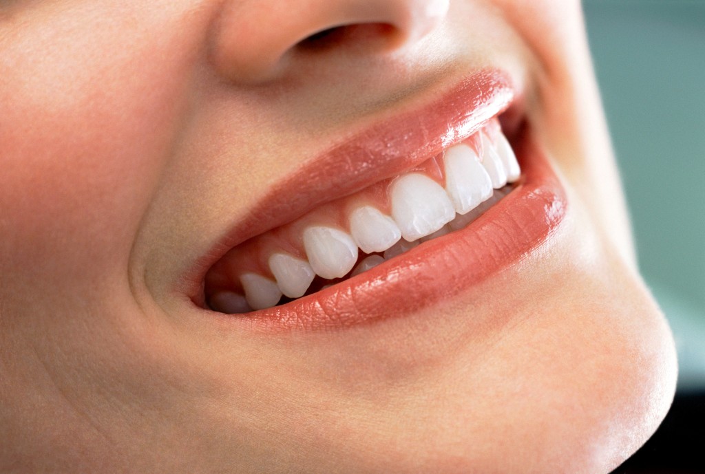 a closeup shot of a smiling woman showing her porcelain veneers